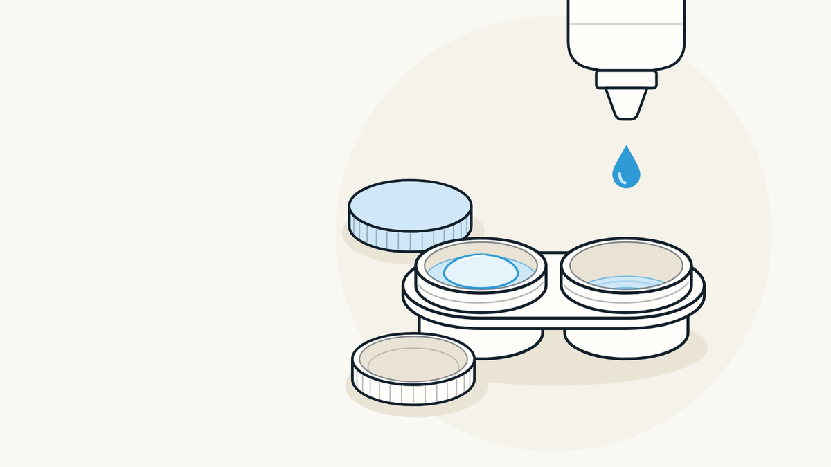 Illustration of an open contact lens case: a soft lens rests in solution while a drop of fresh solution falls from a bottle into the other well, which is just starting to fill.