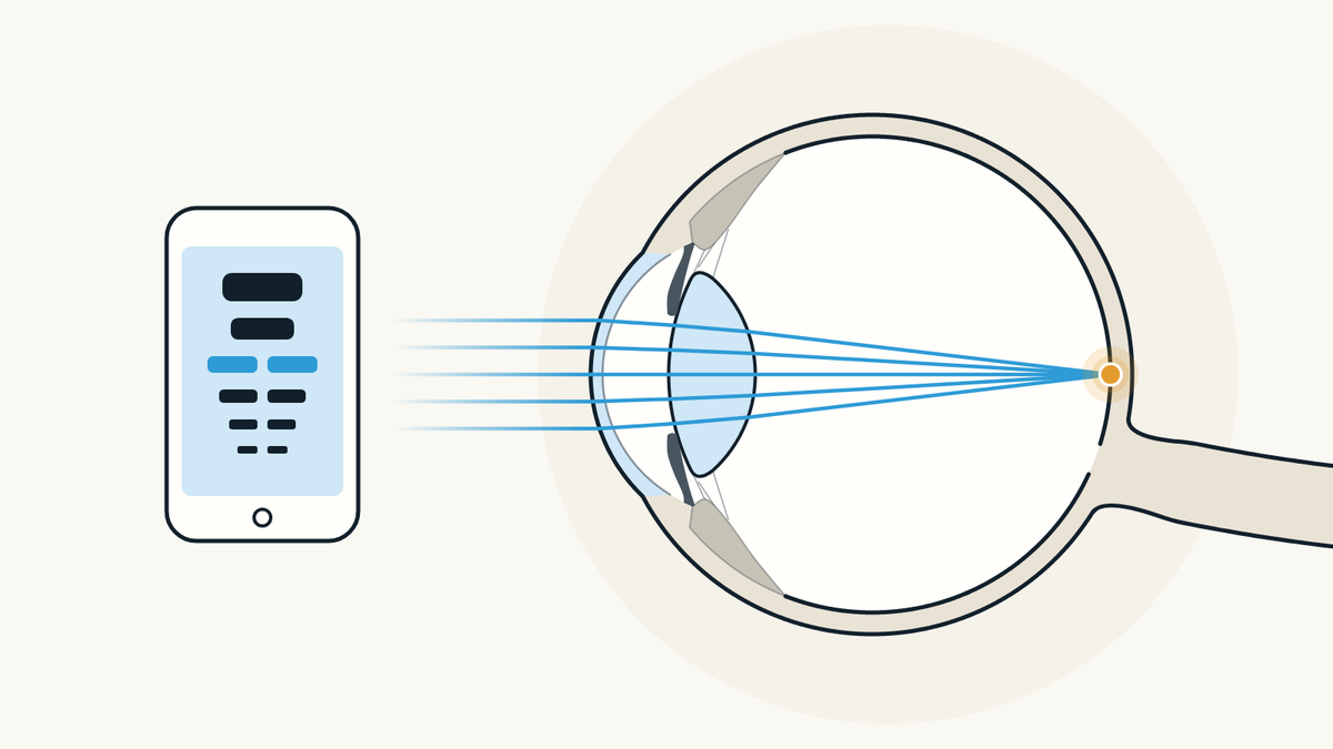 Illustration of a phone showing a reading chart, and an eye seen from the side that focuses light on the retina.